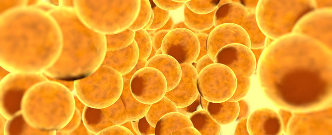 Grasso viscerale, cosa è, quali sono i rischi per la salute, come ridurlo